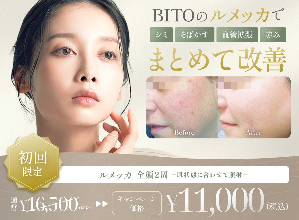 ルメッカ