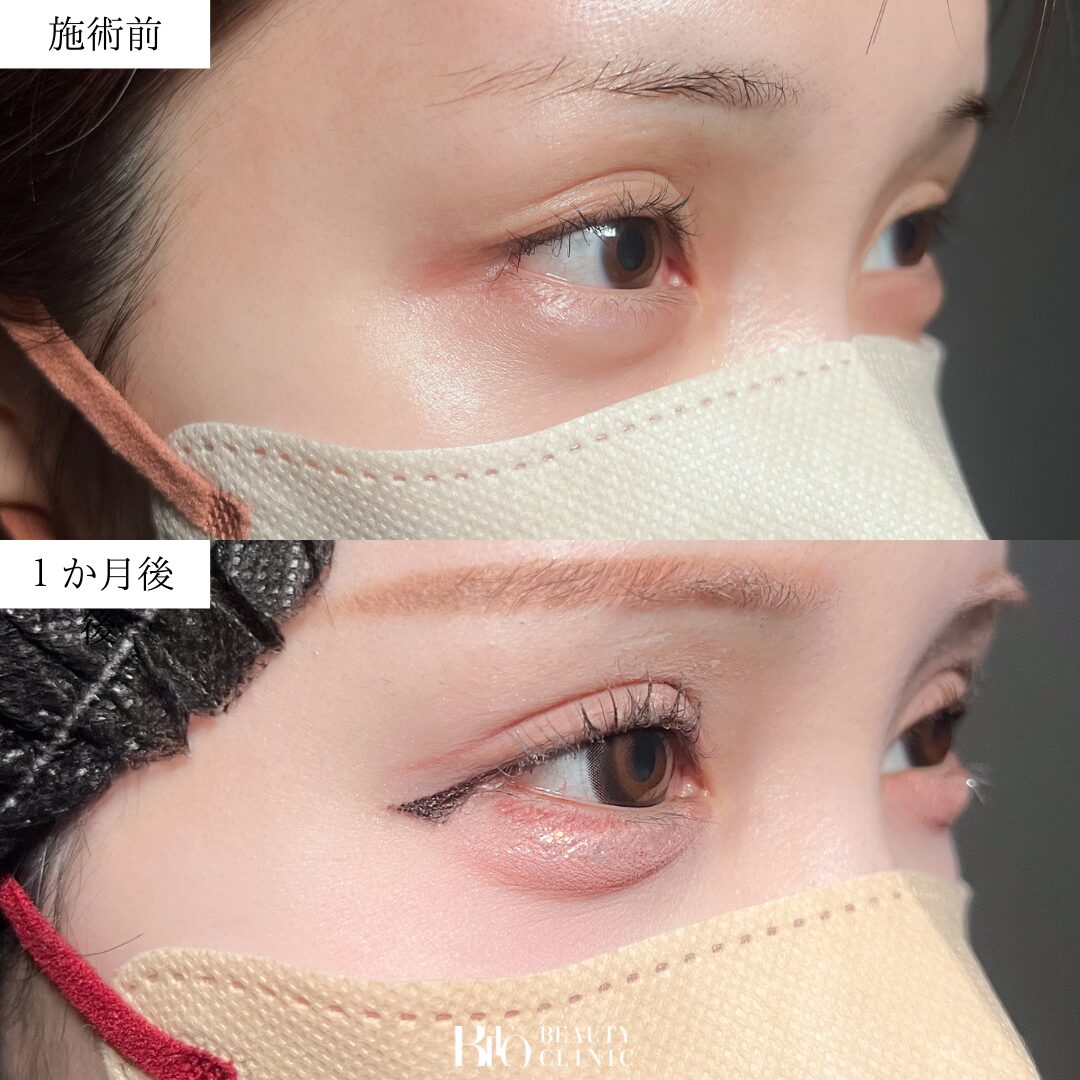 症例写真