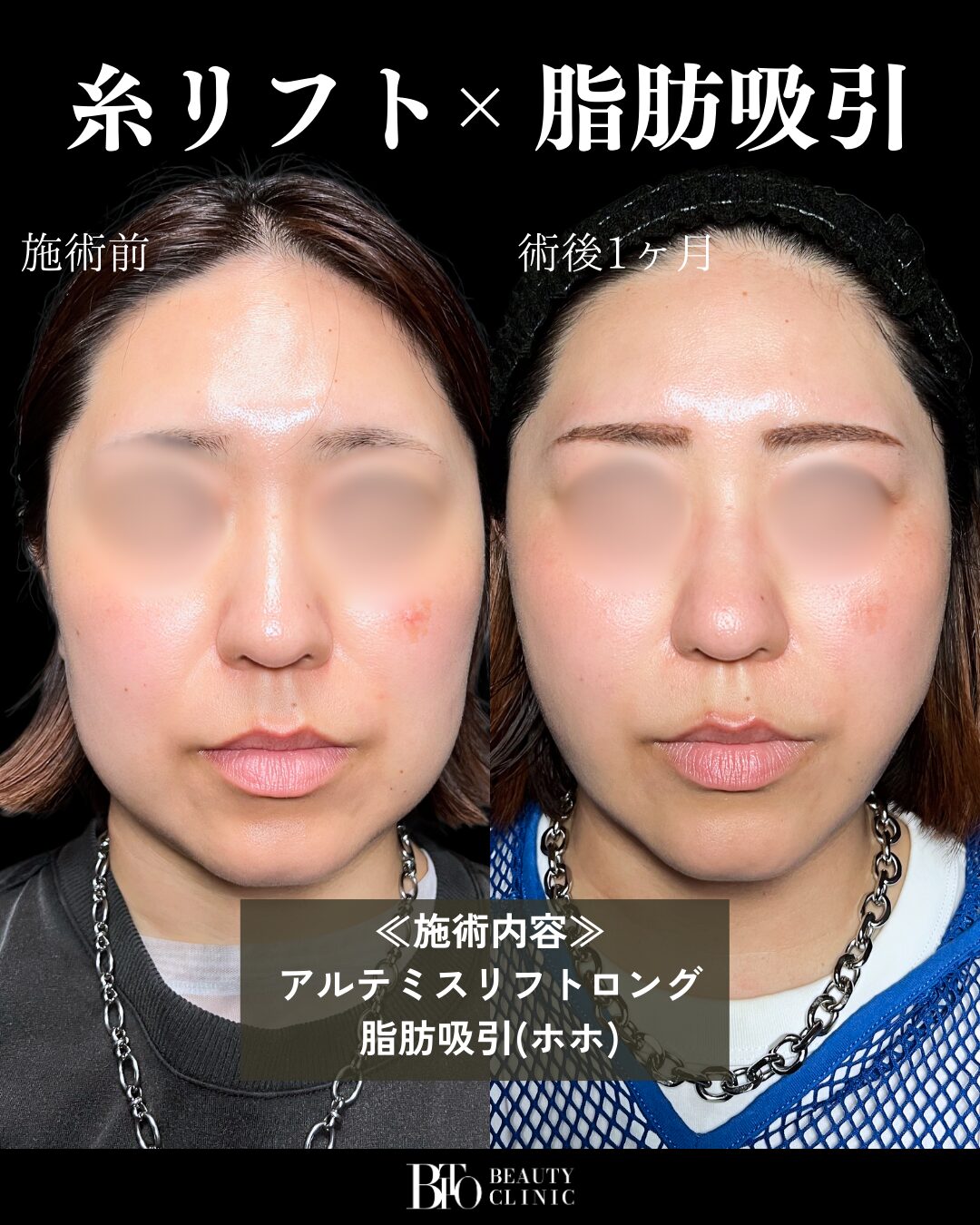 症例写真