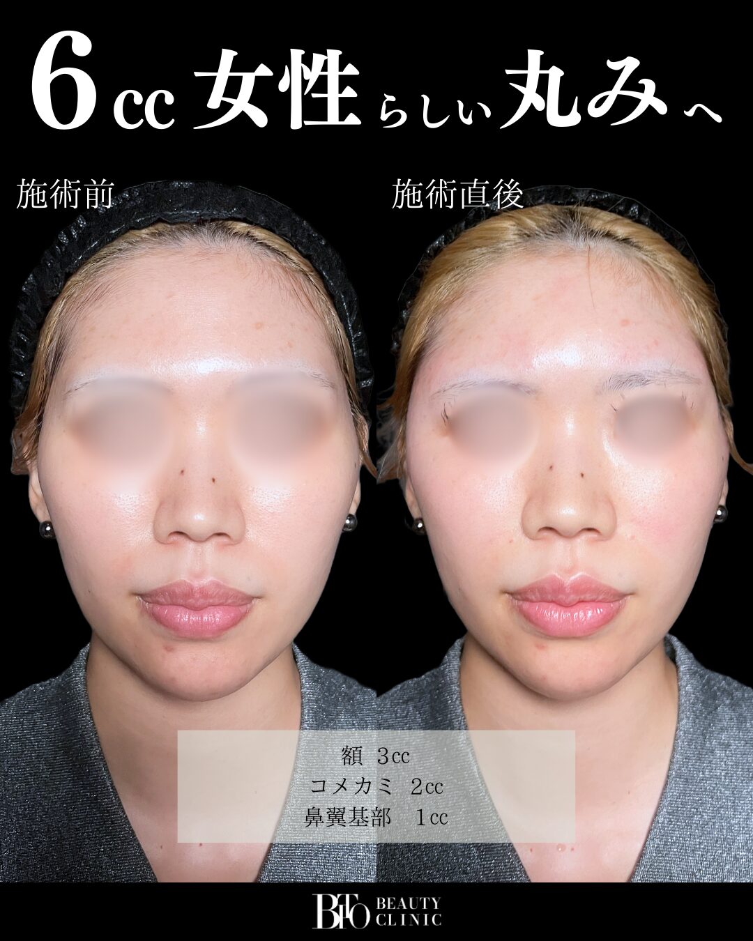 症例写真
