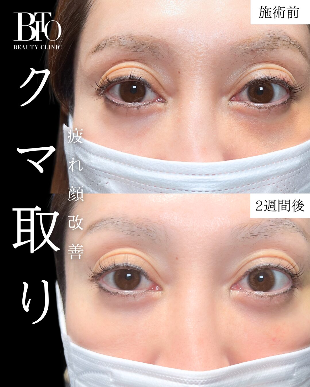症例写真