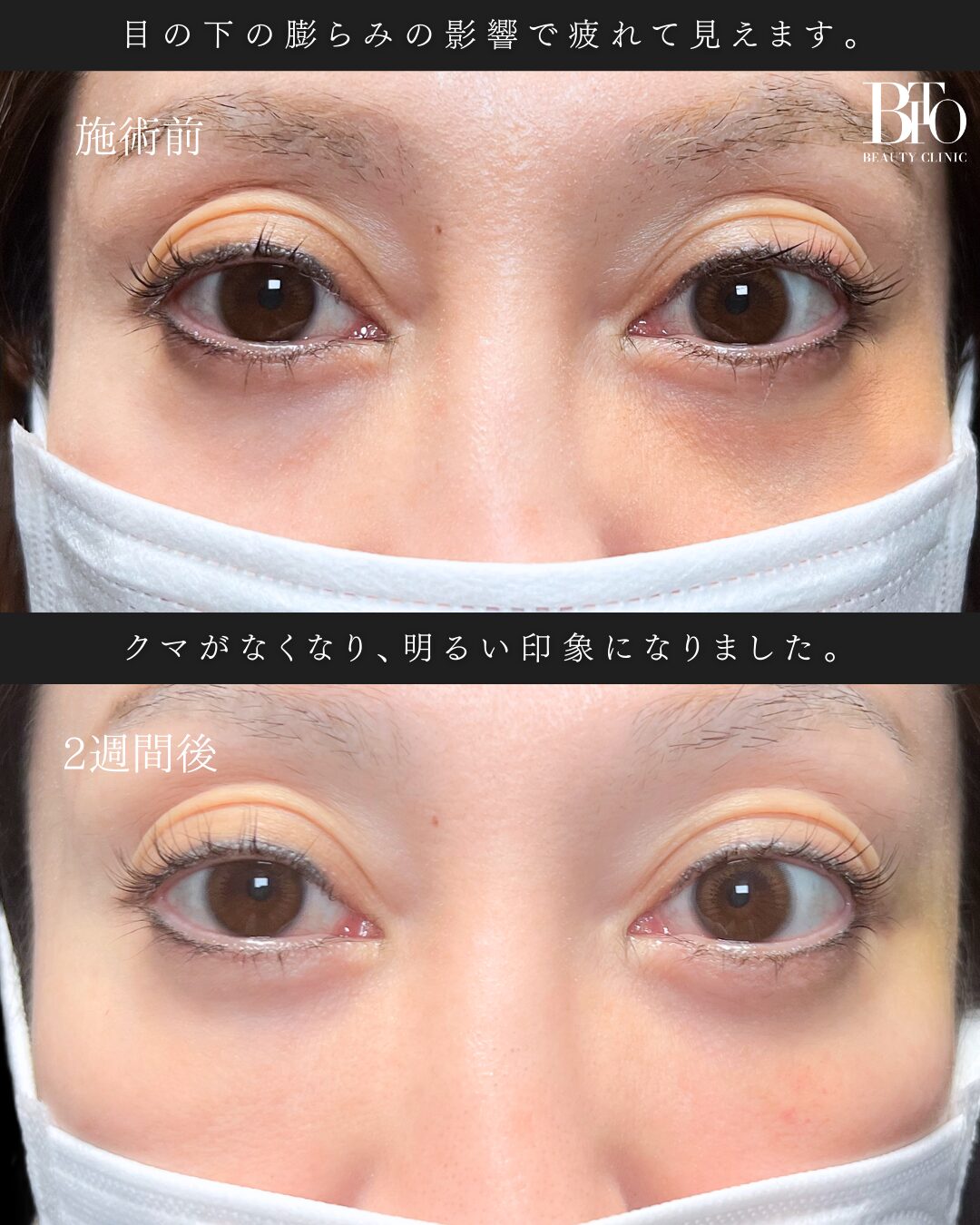 症例写真
