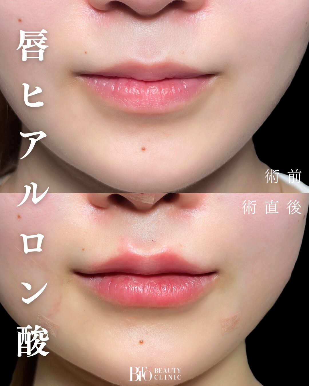 症例写真