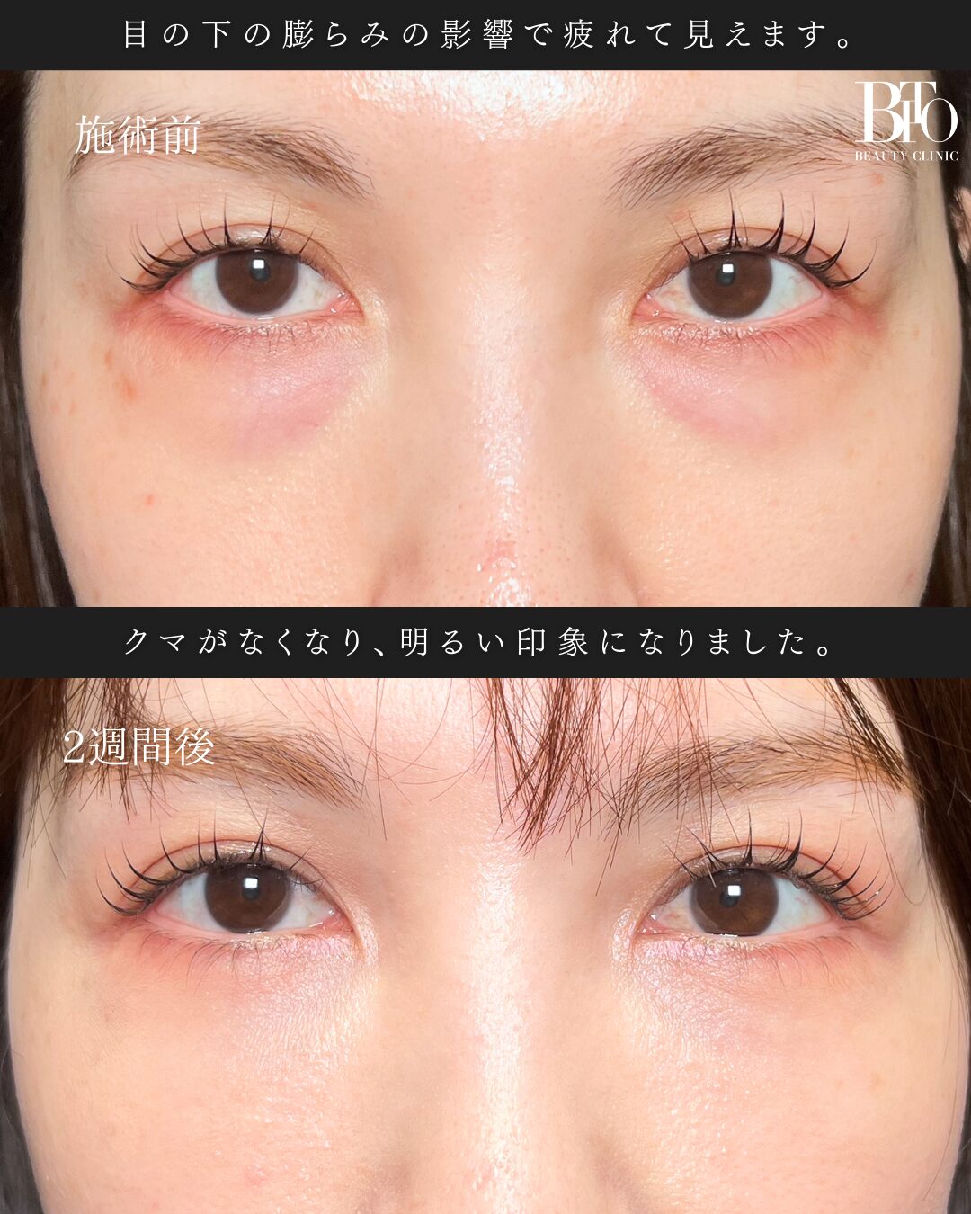 症例写真