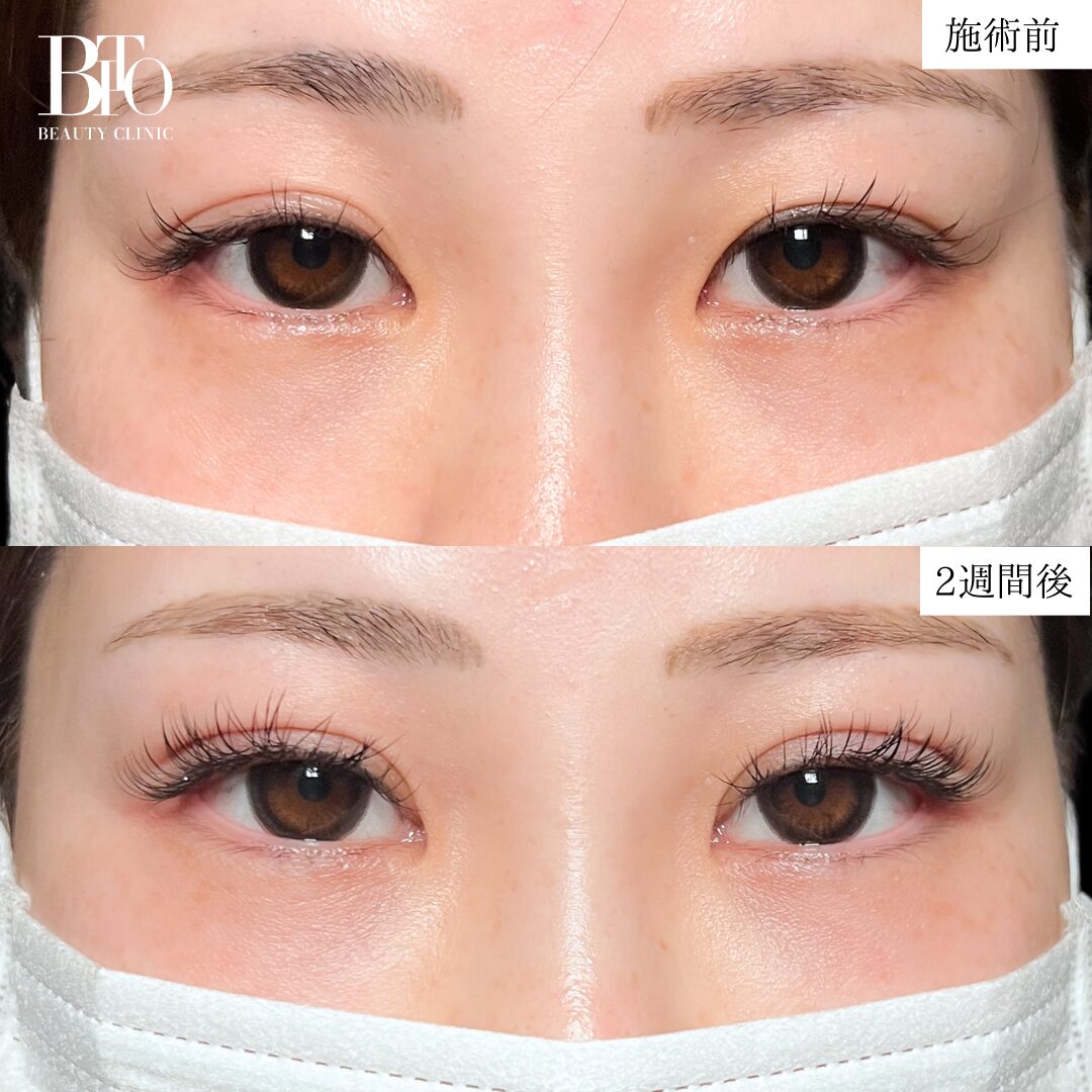 症例写真
