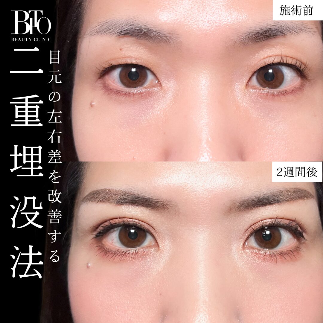 症例写真