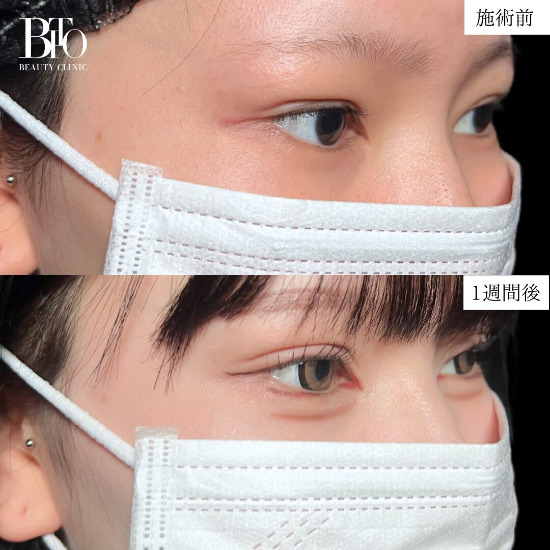 症例写真