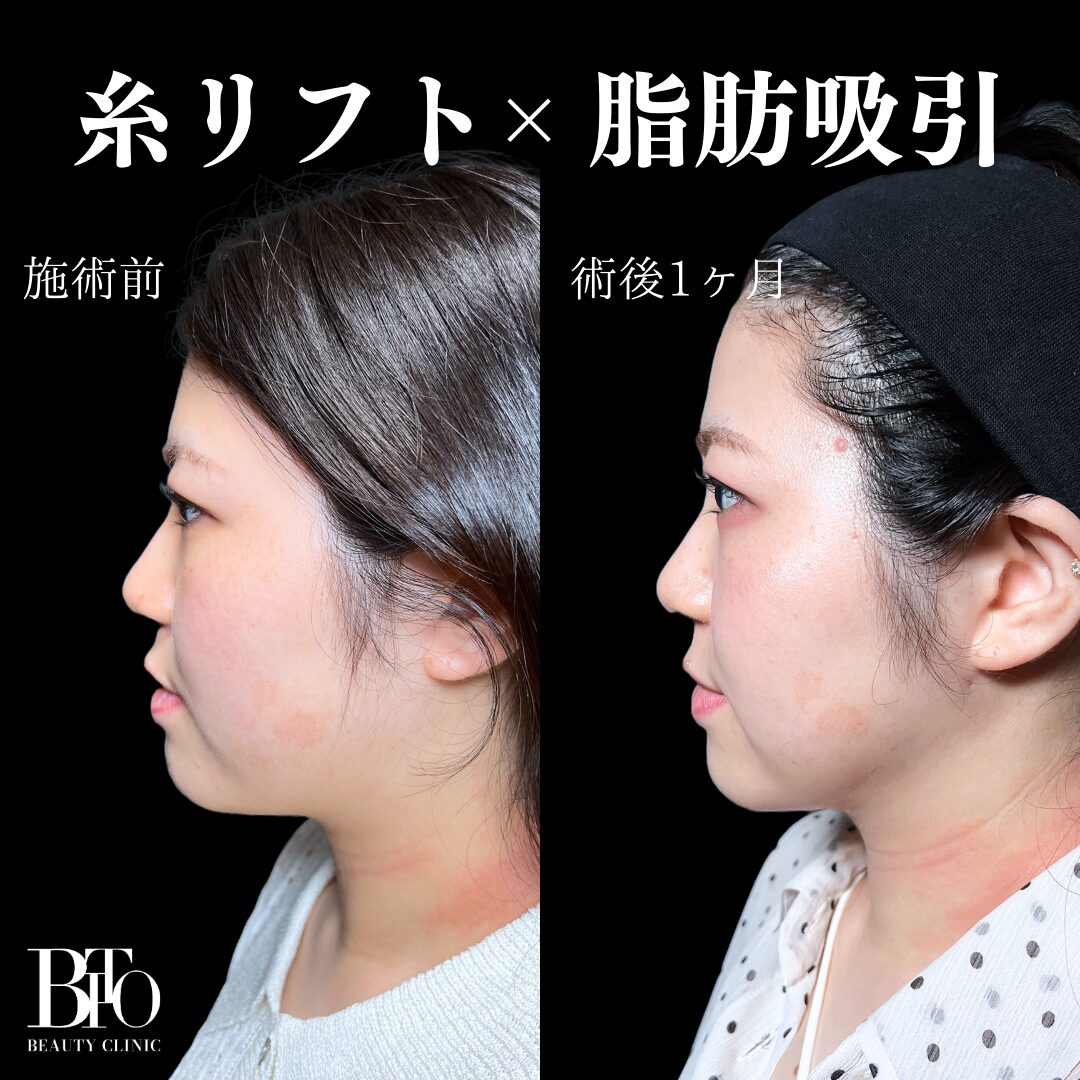 症例写真