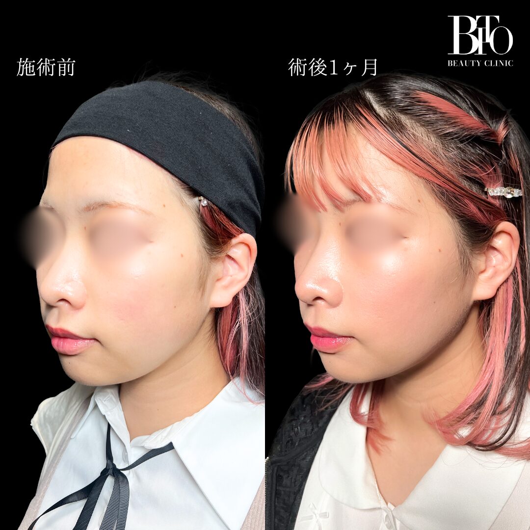 症例写真