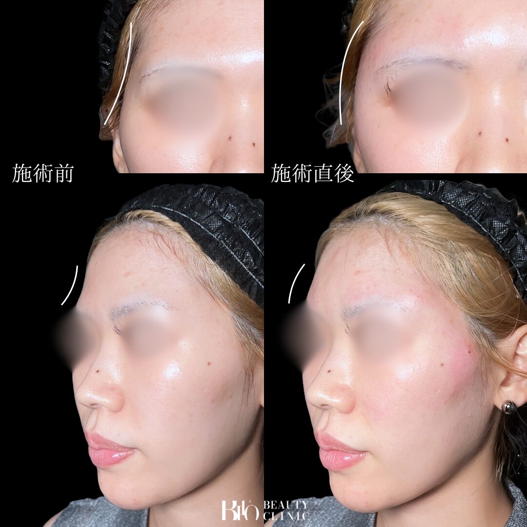 症例写真