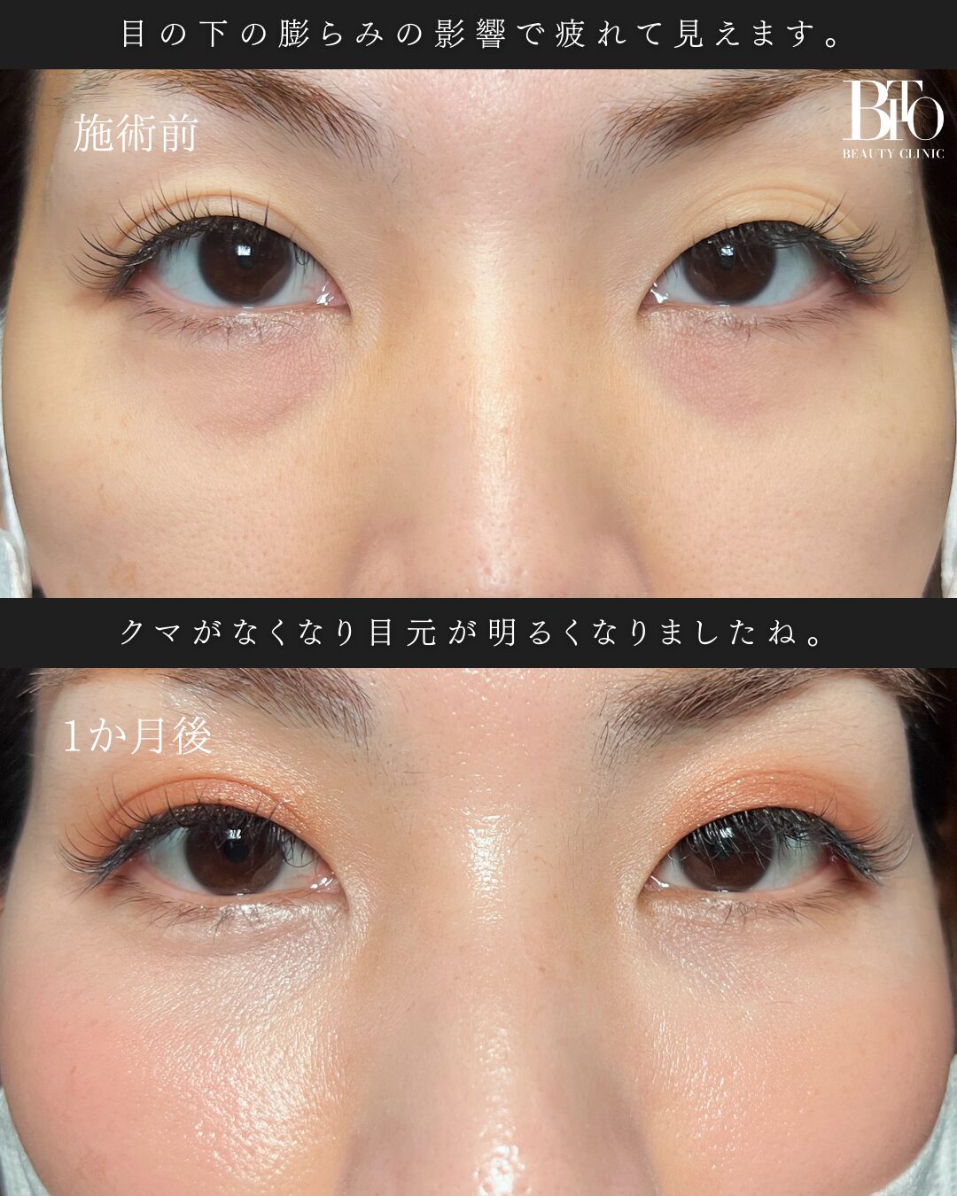 症例写真