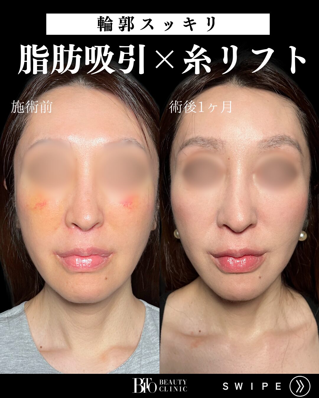 症例写真