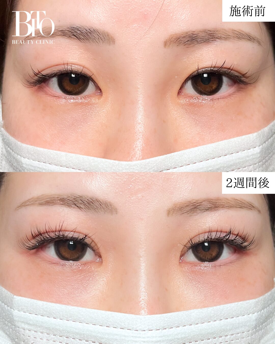 症例写真