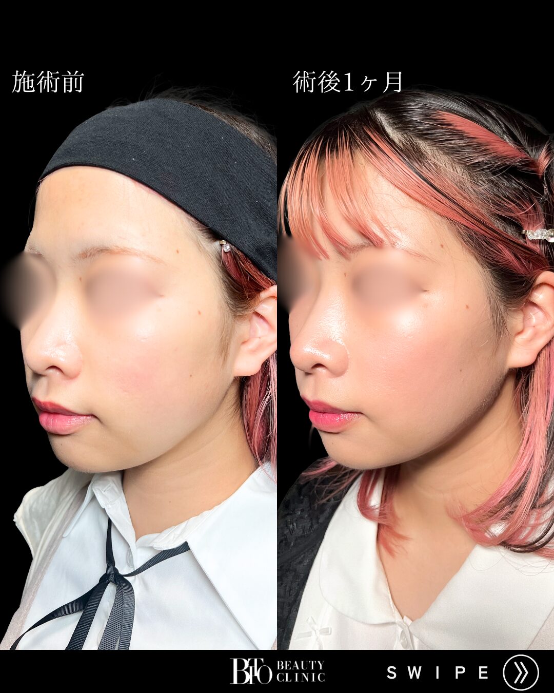 症例写真