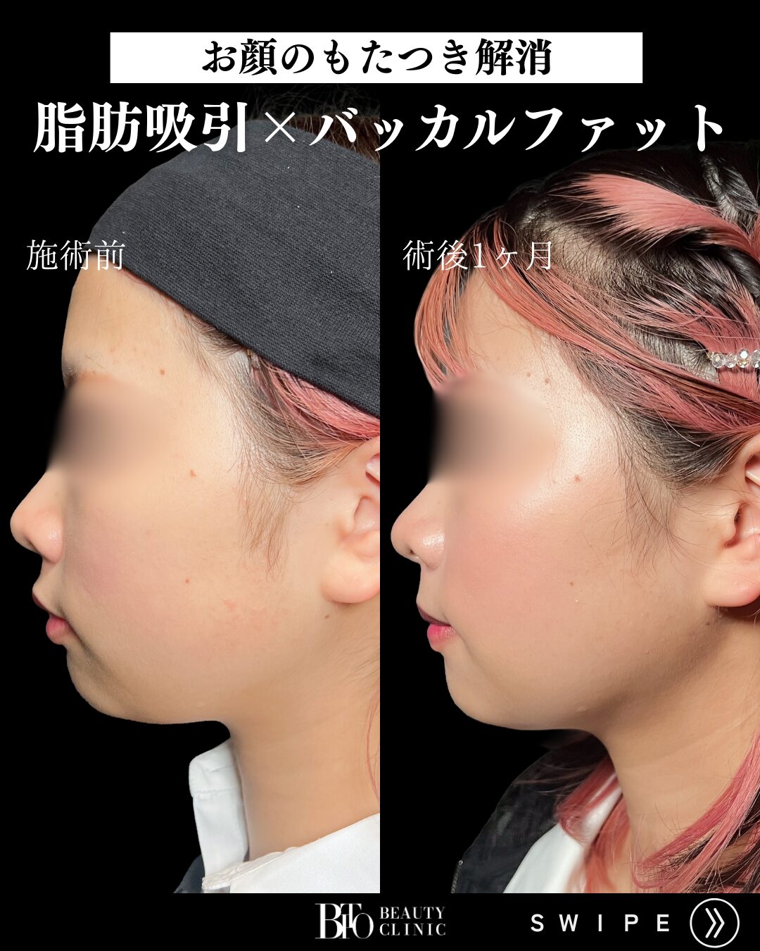症例写真
