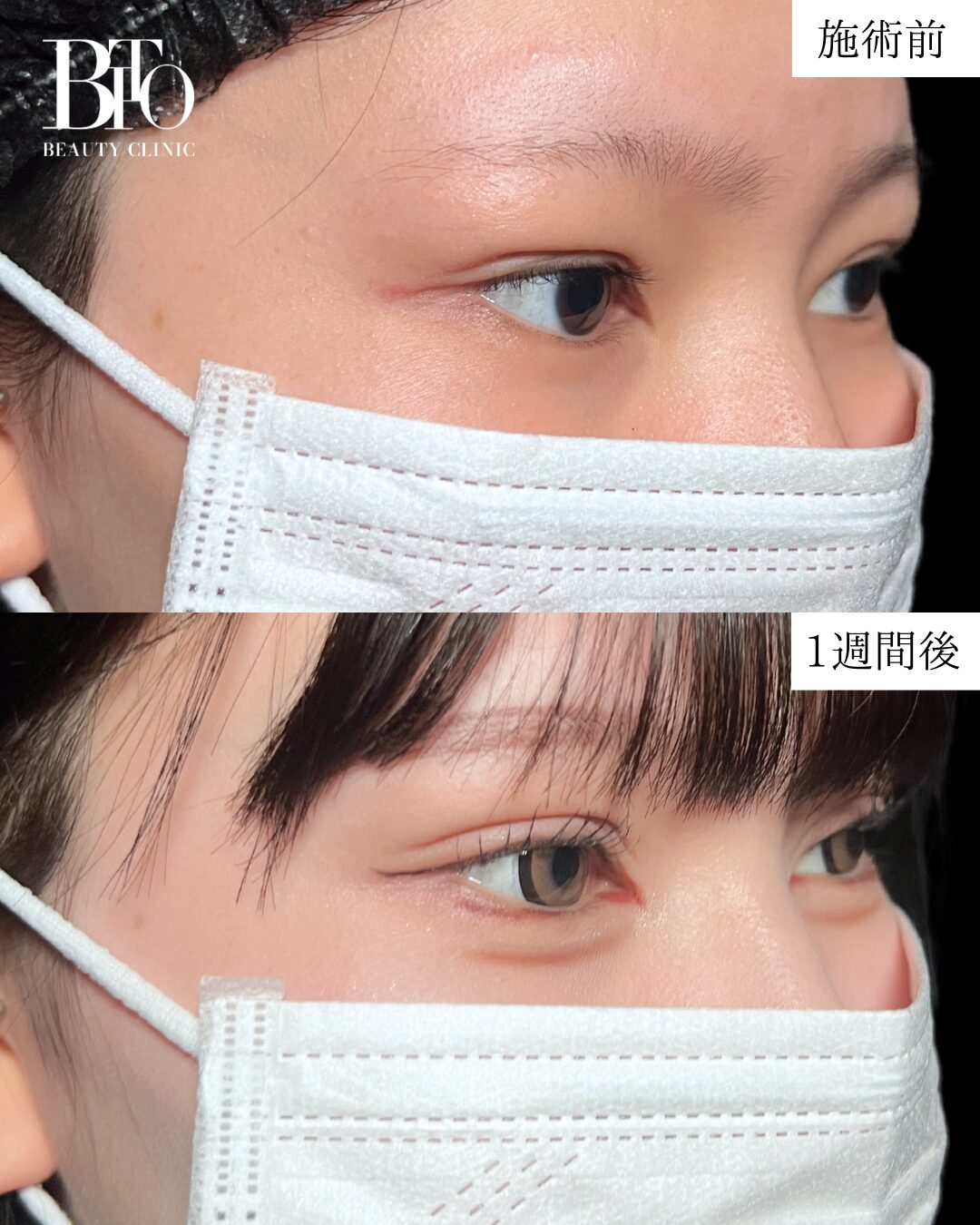 症例写真