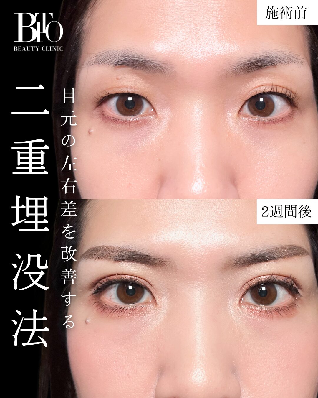 症例写真