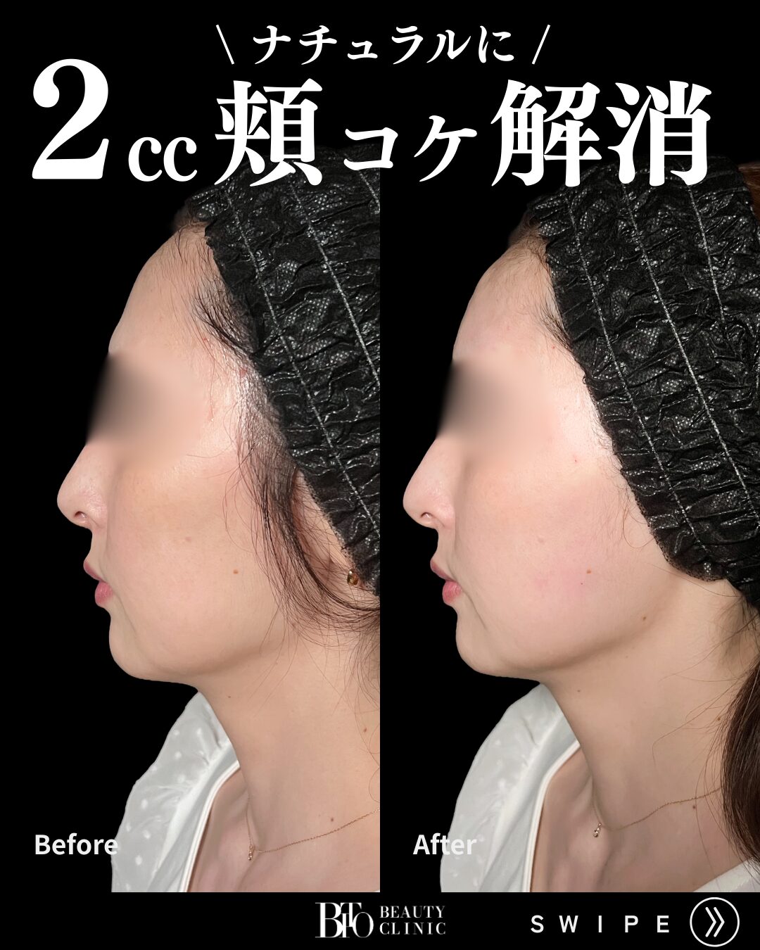 症例写真
