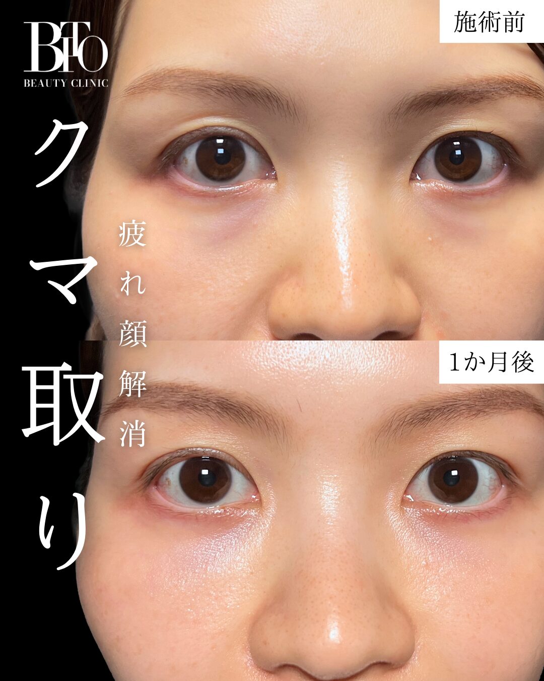 症例写真