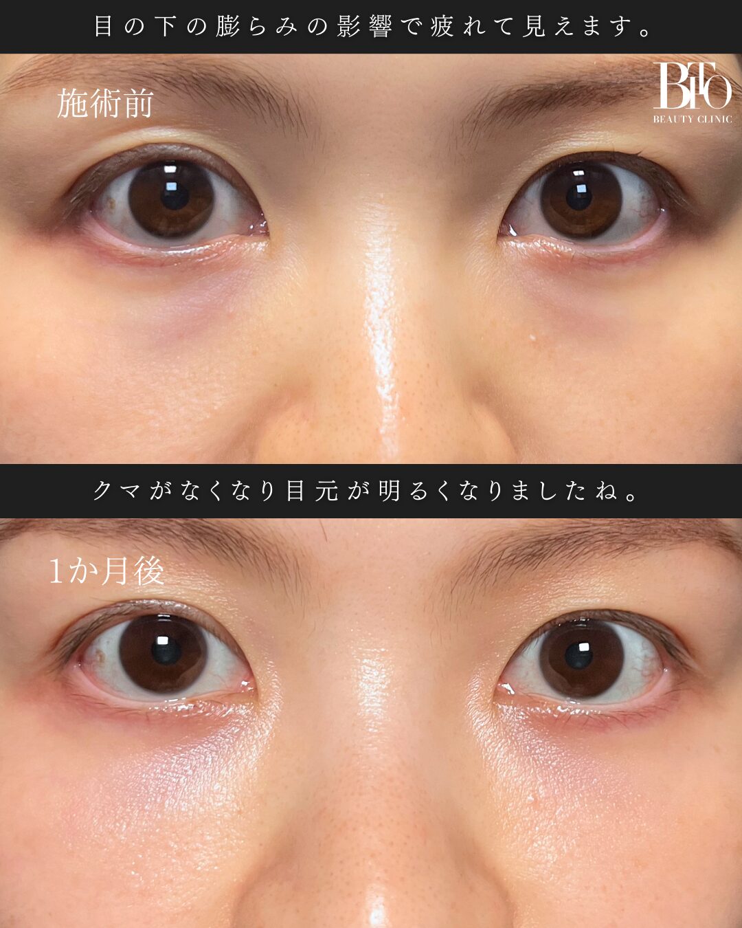 症例写真