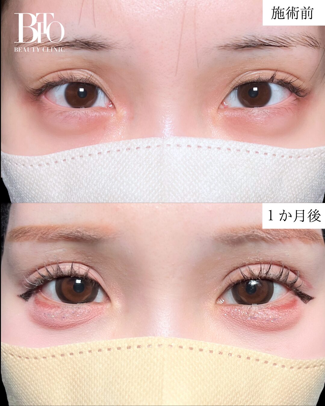 症例写真