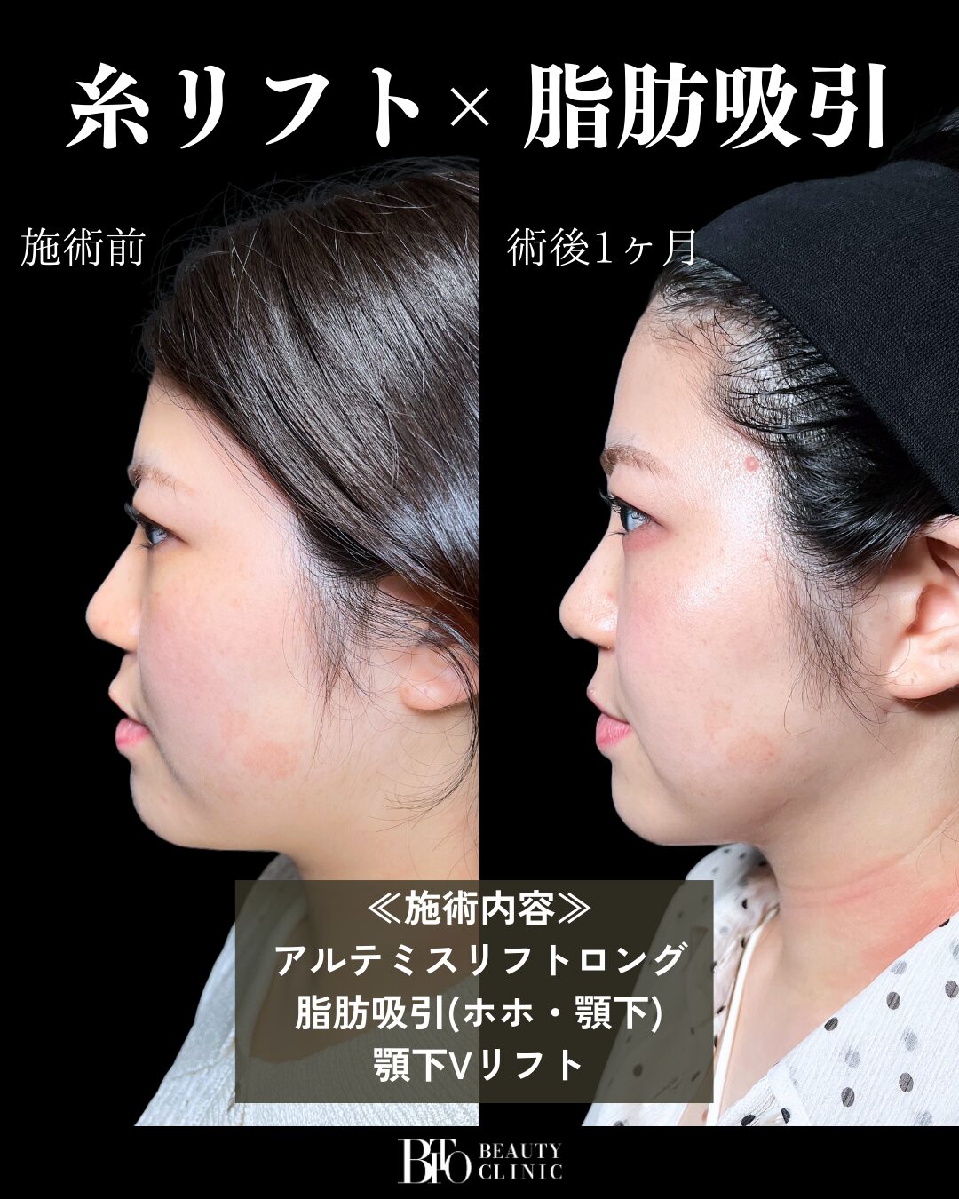 症例写真