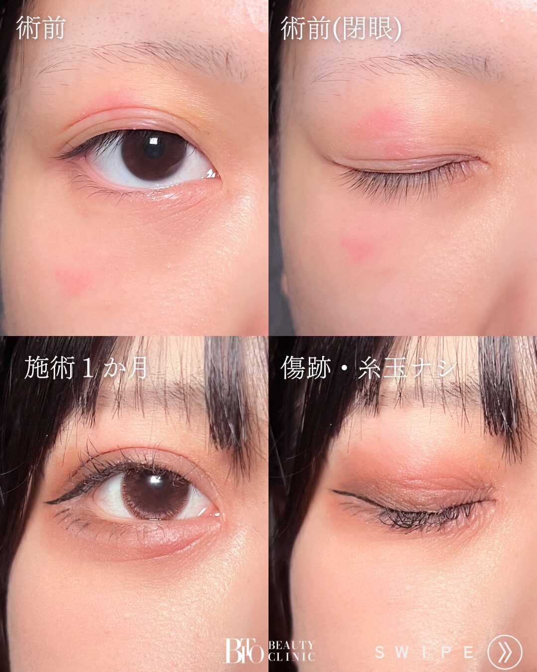 症例写真