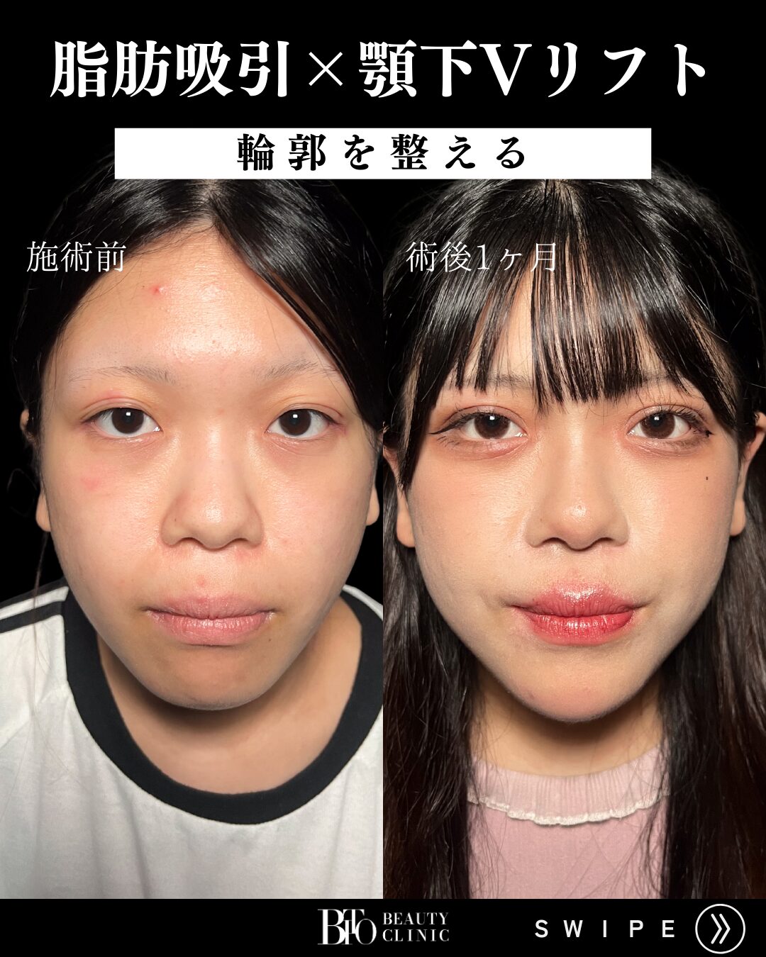 症例写真