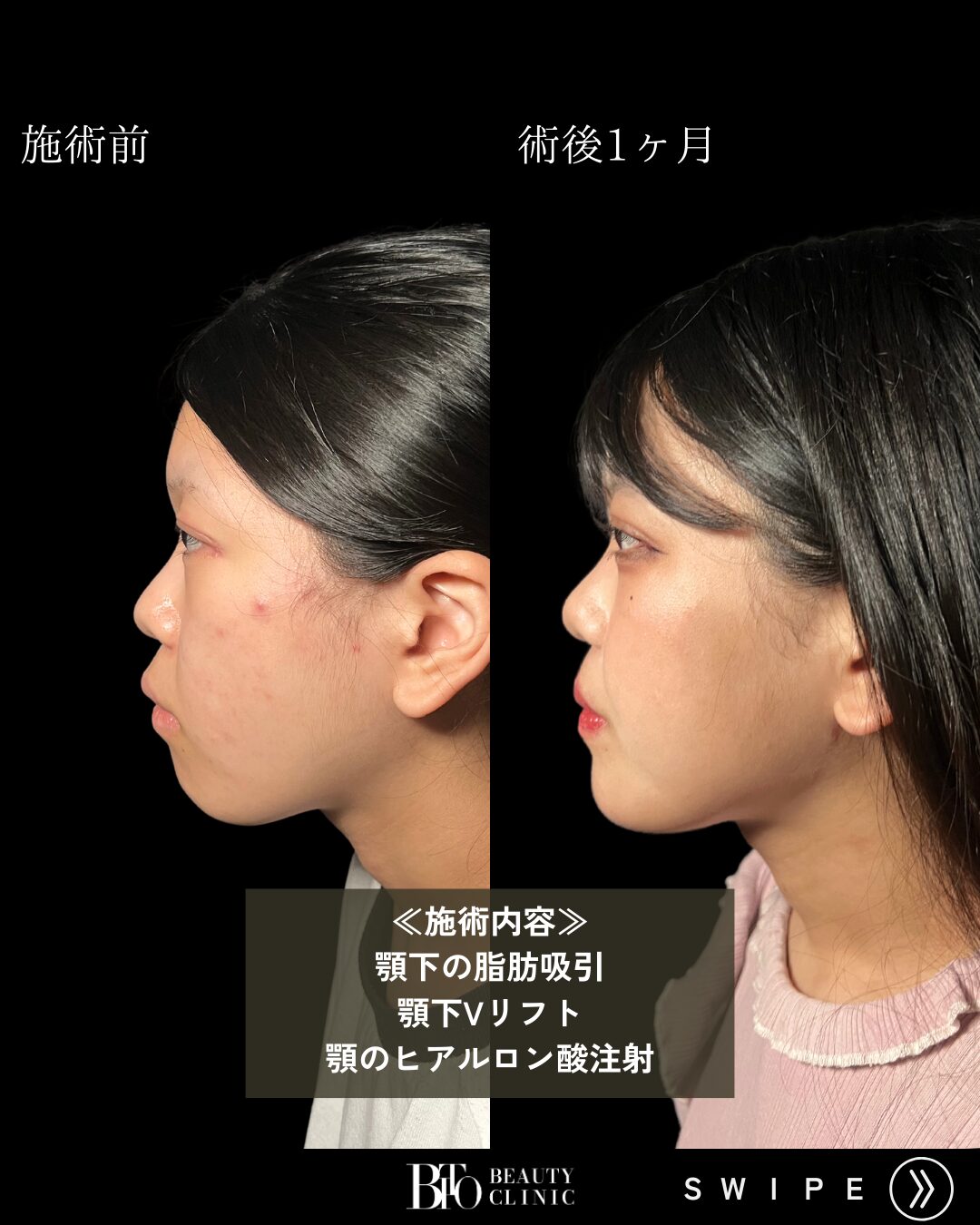 症例写真