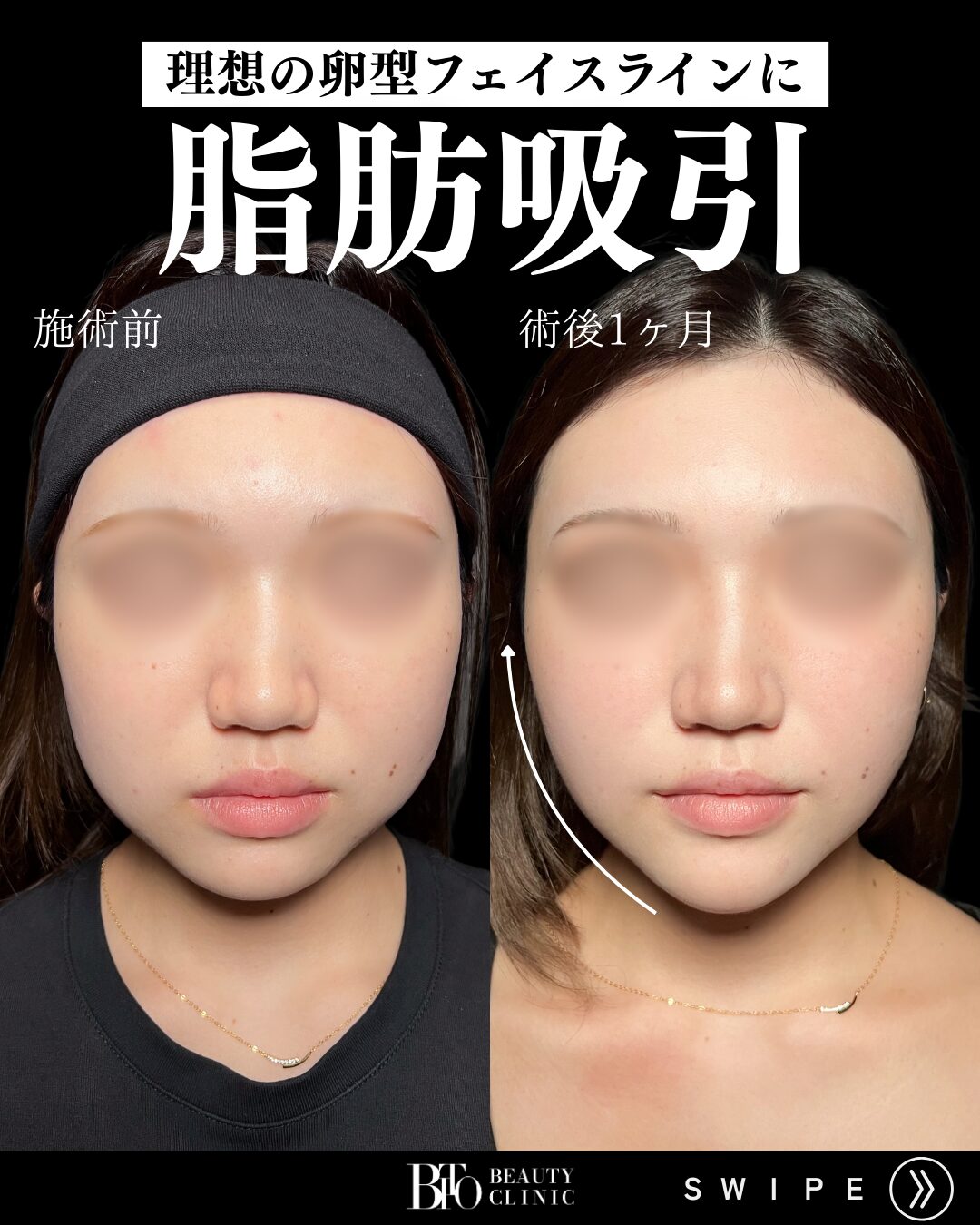 症例写真
