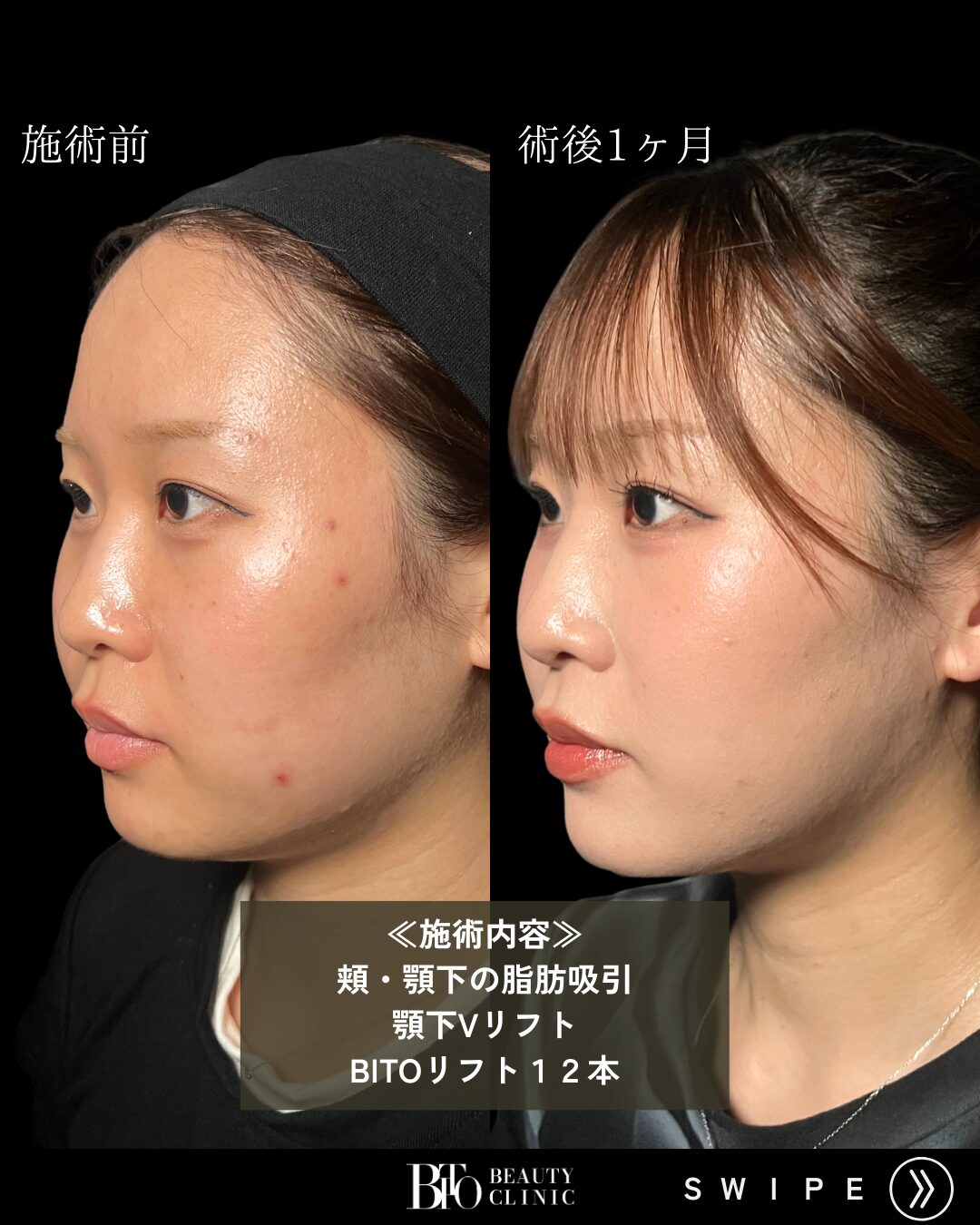 症例写真