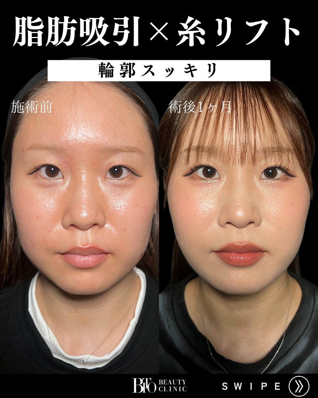 症例写真