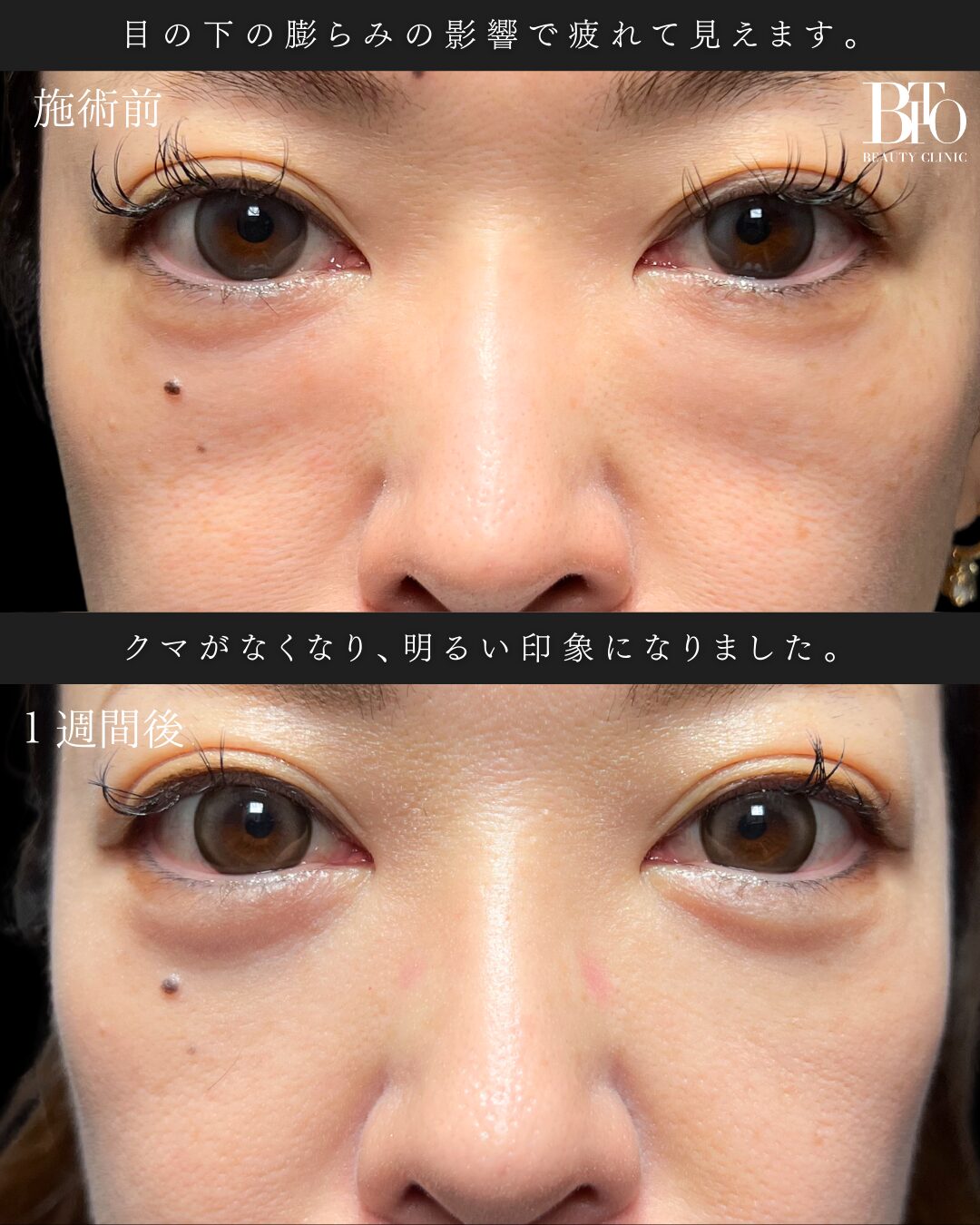 症例写真