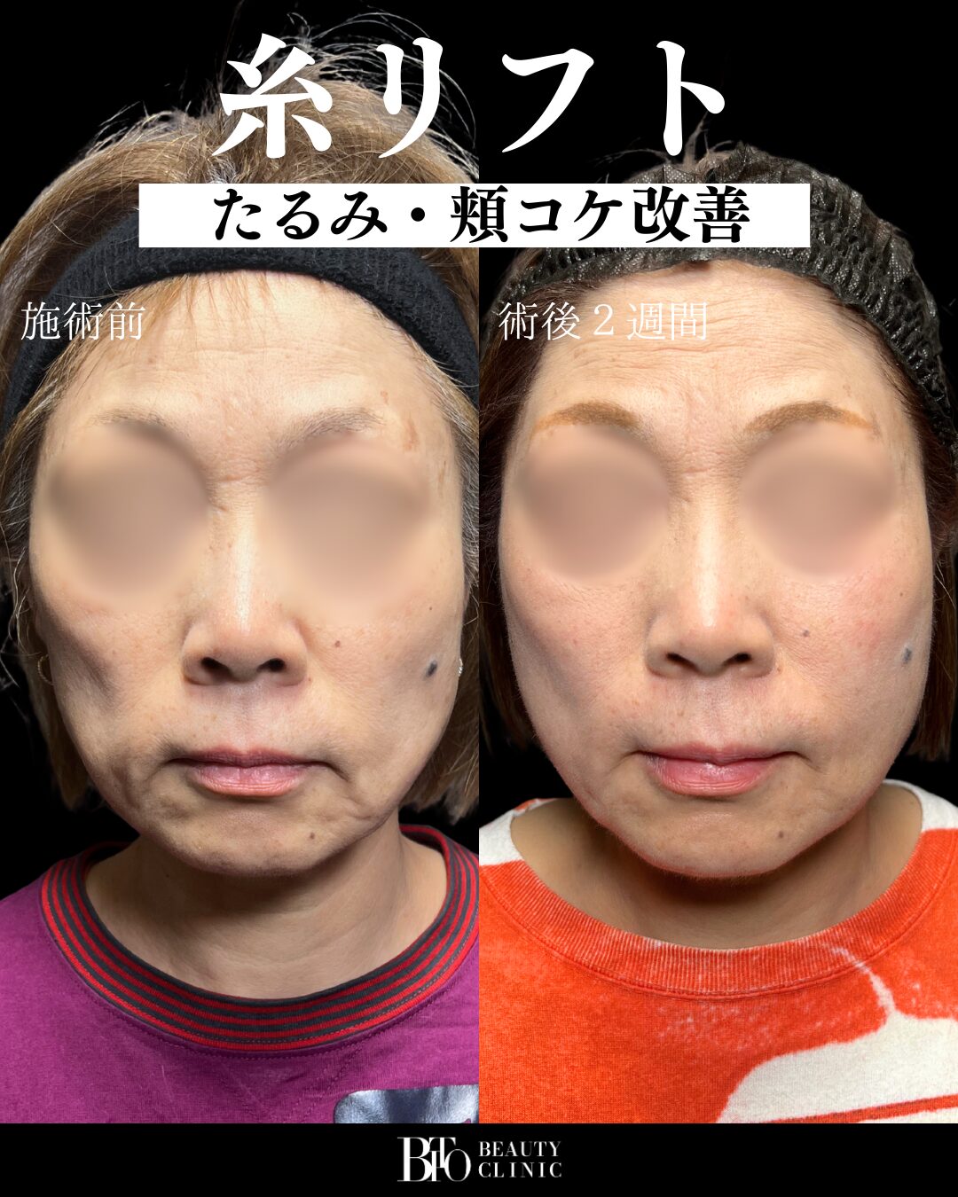 症例写真