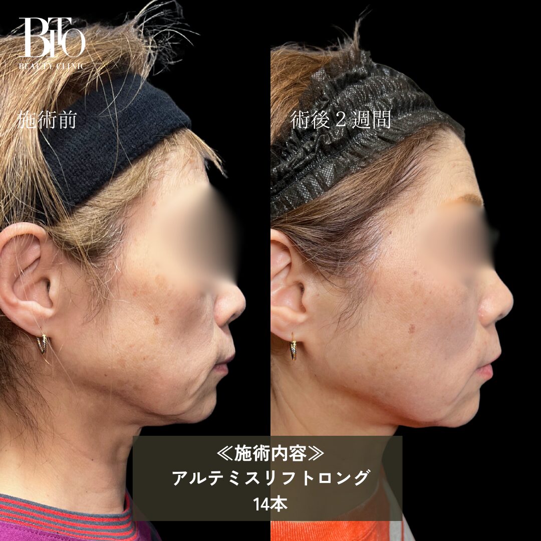 症例写真