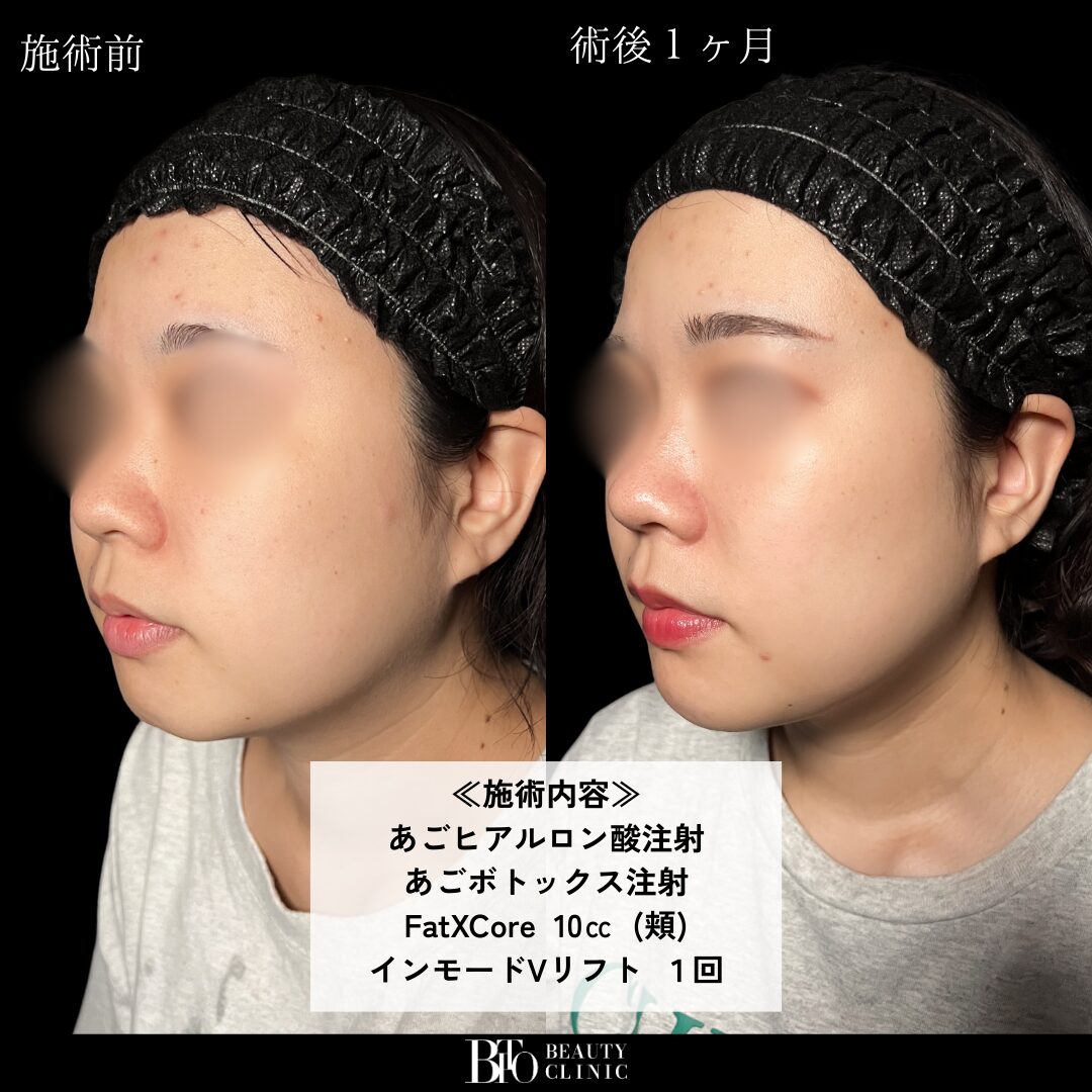 症例写真