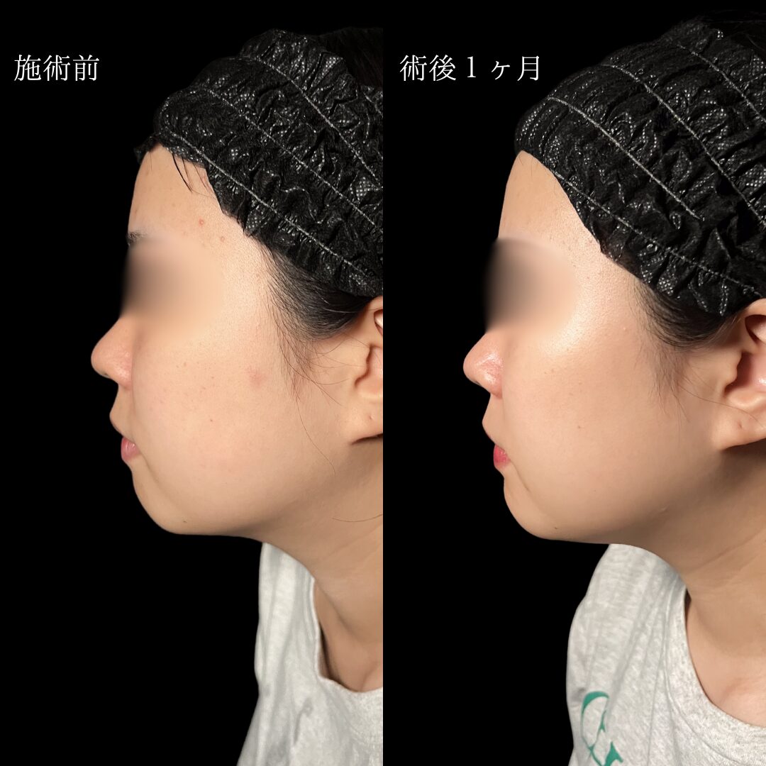 症例写真