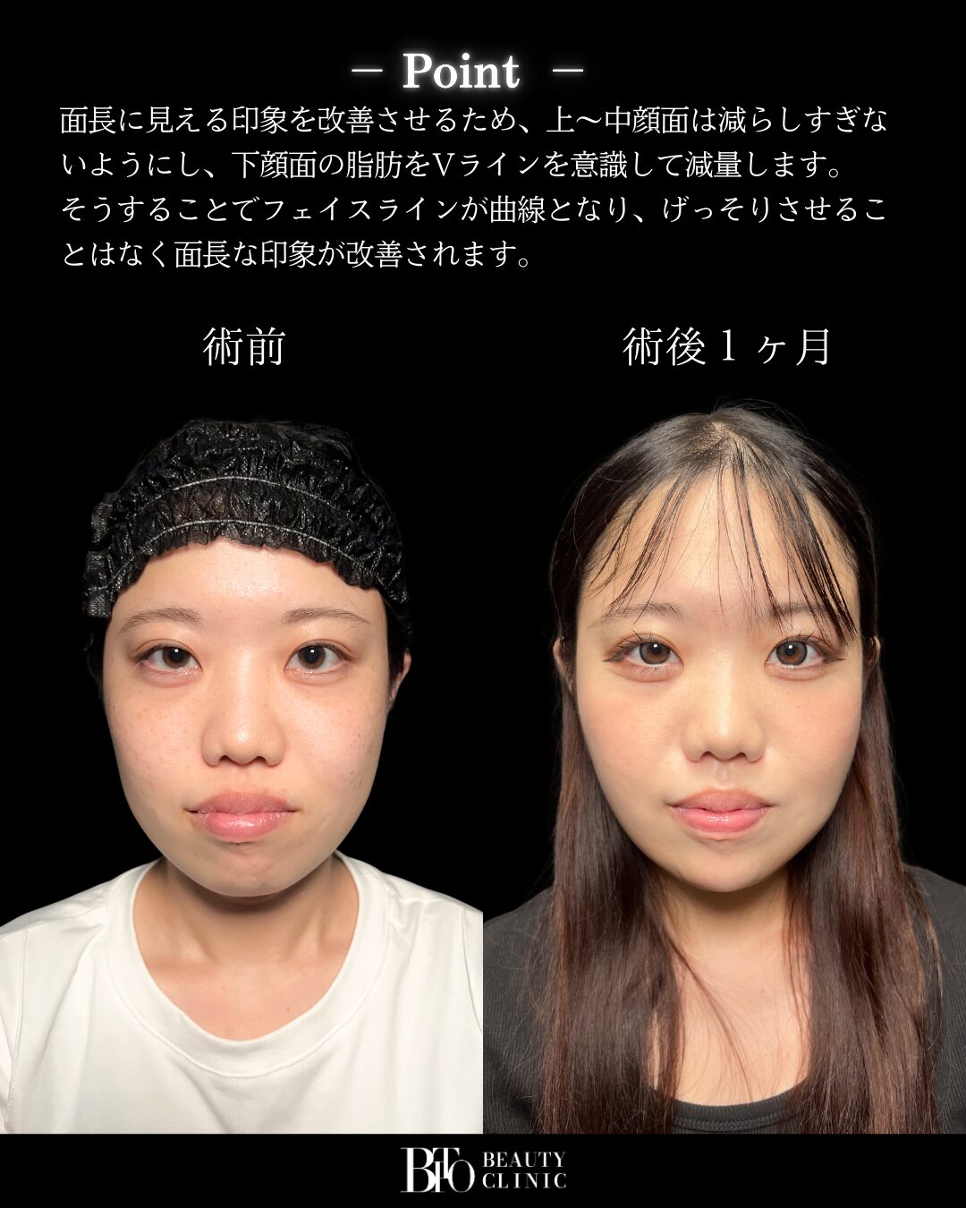 症例写真