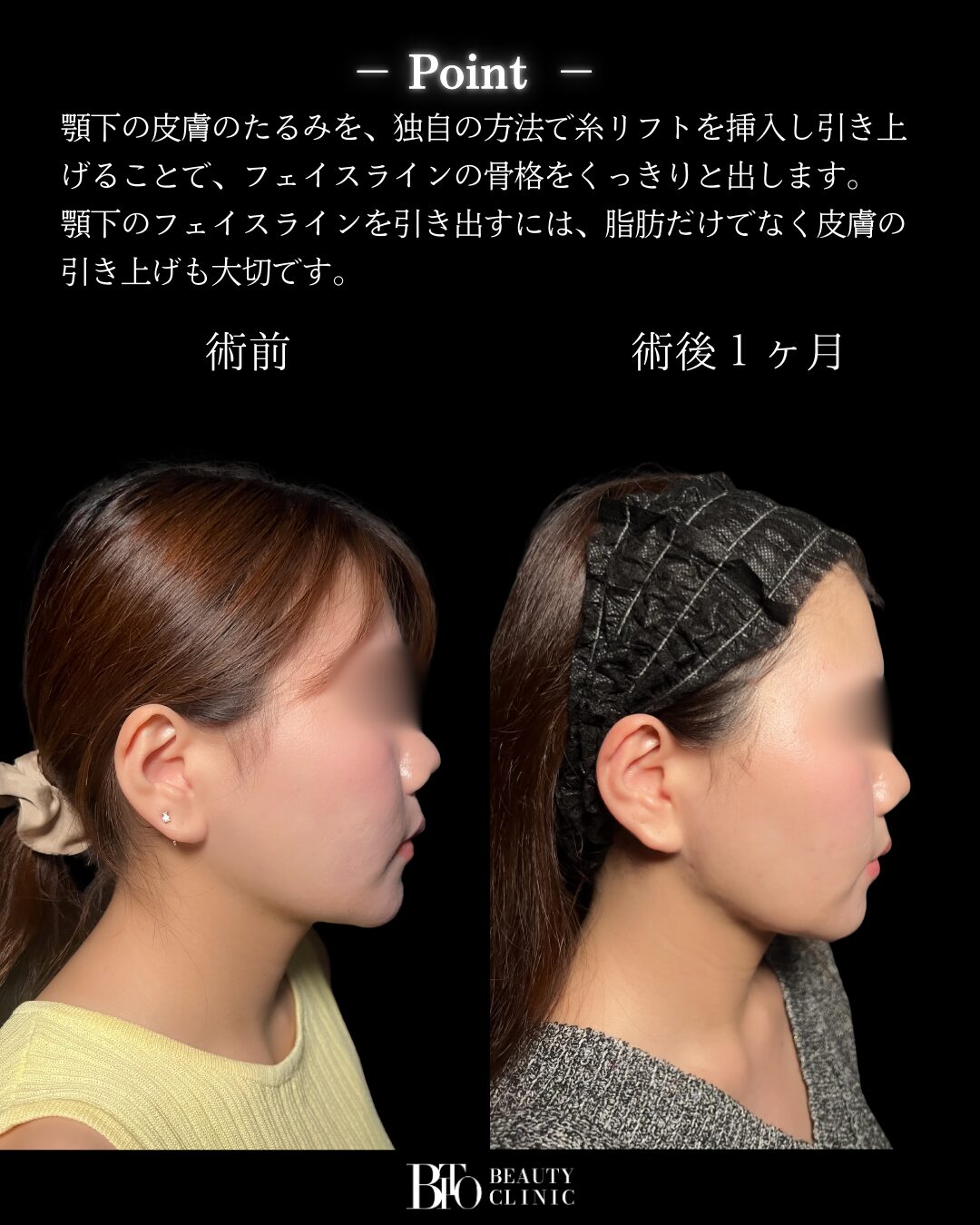 症例写真