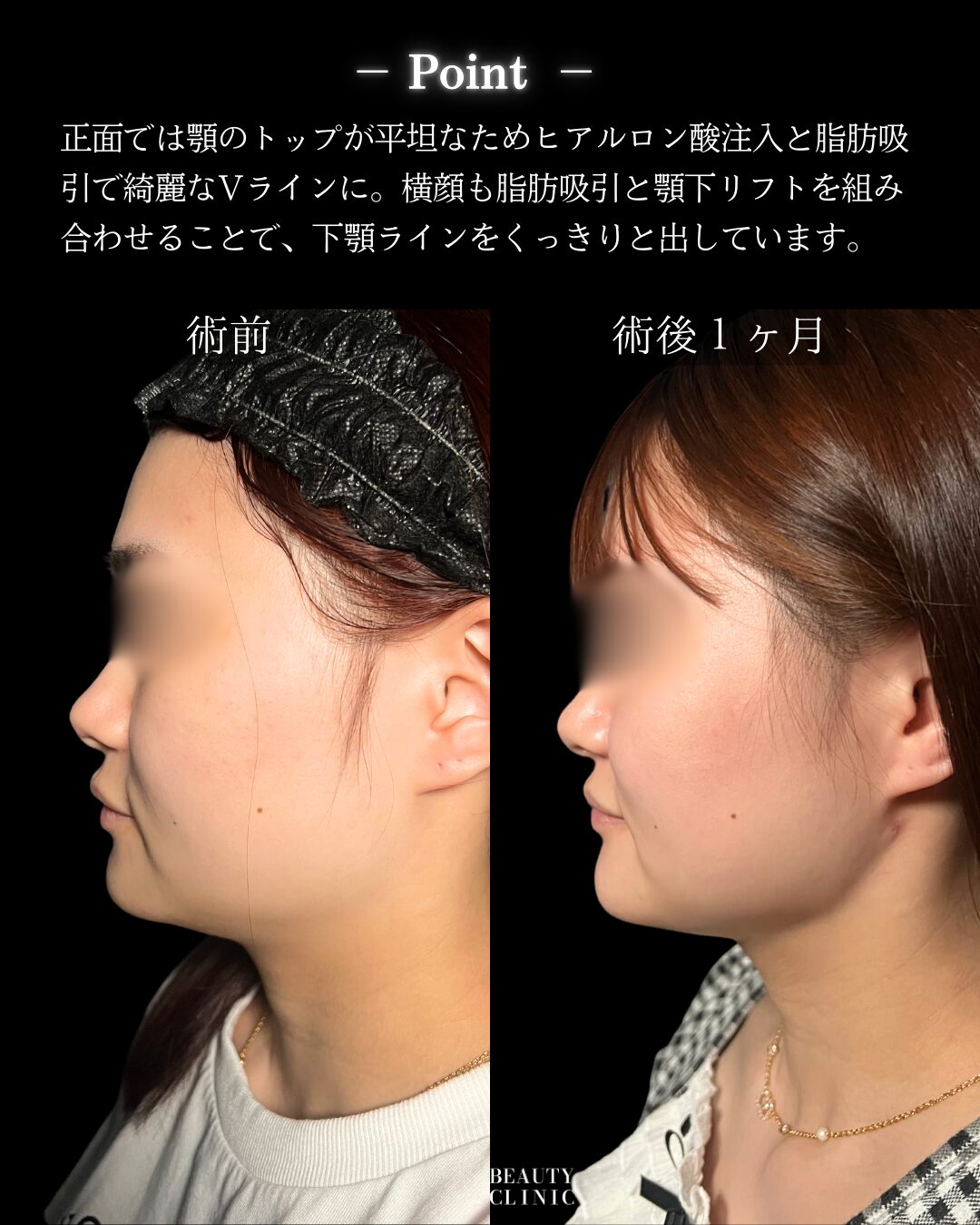症例写真