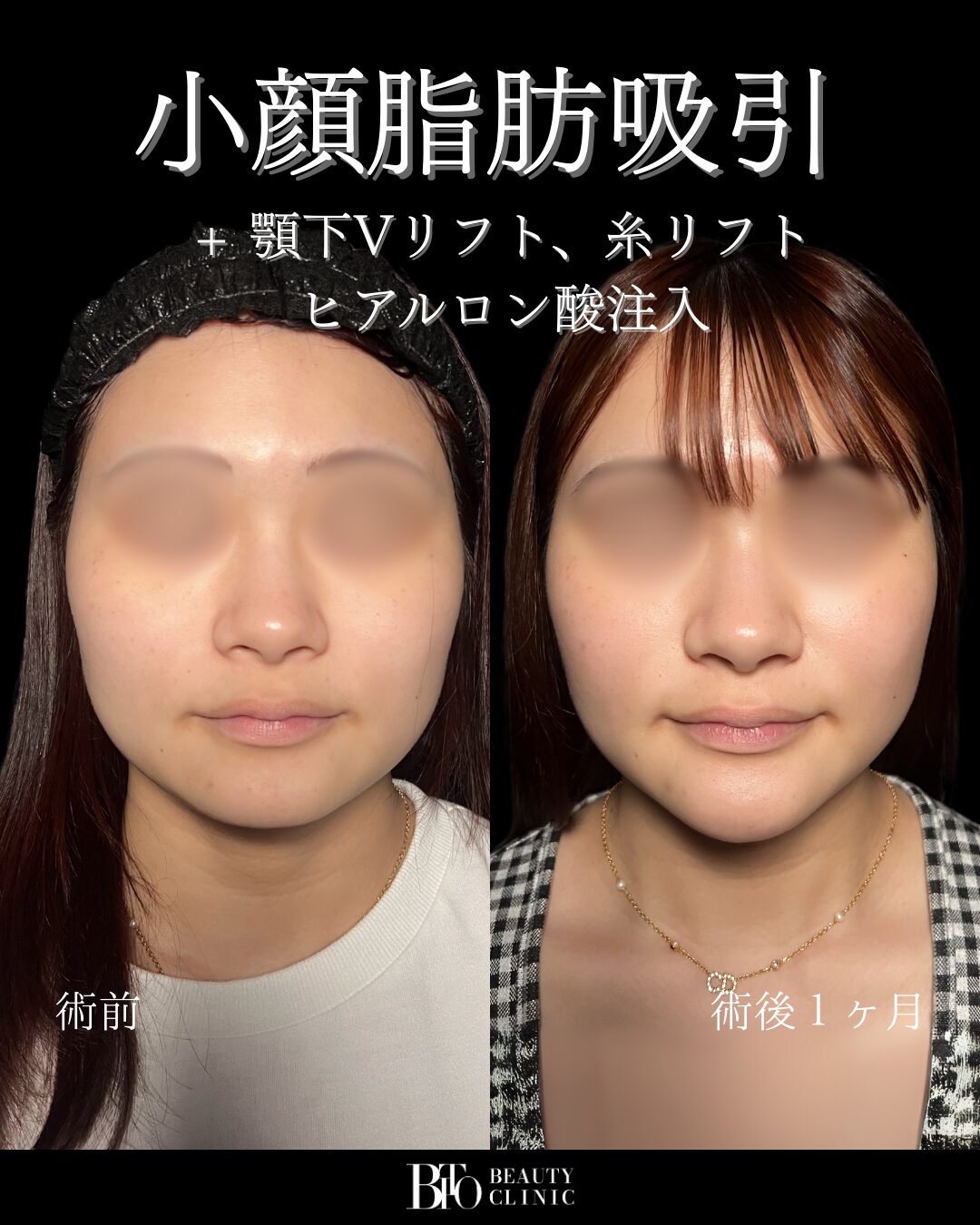 症例写真