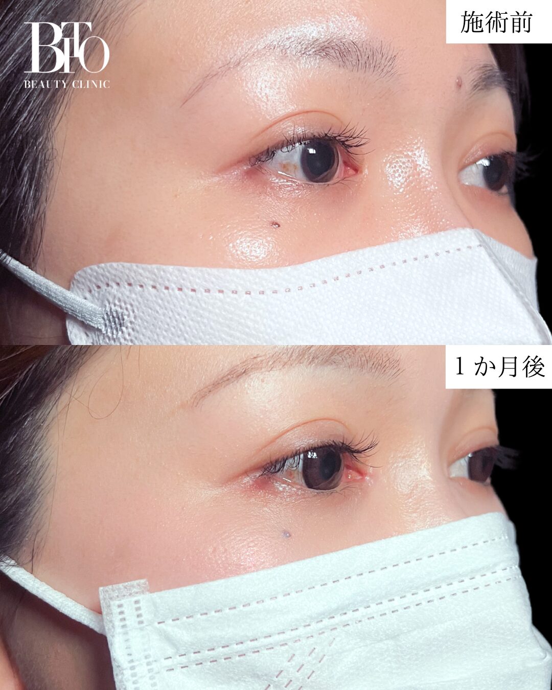 症例写真
