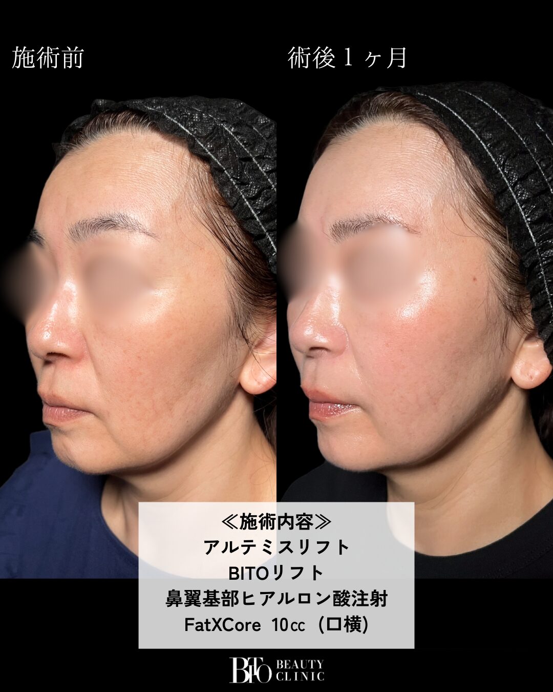 症例写真