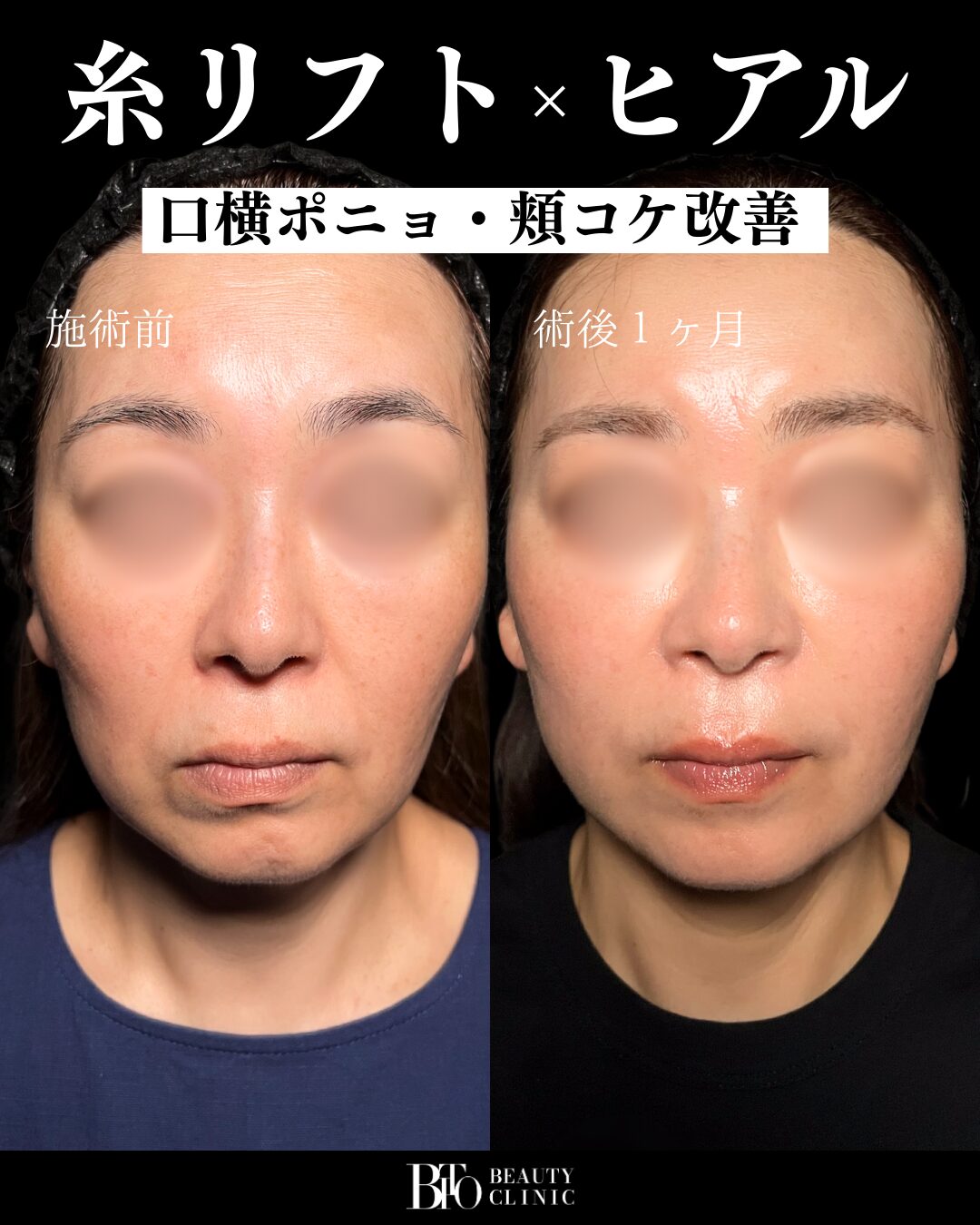 症例写真