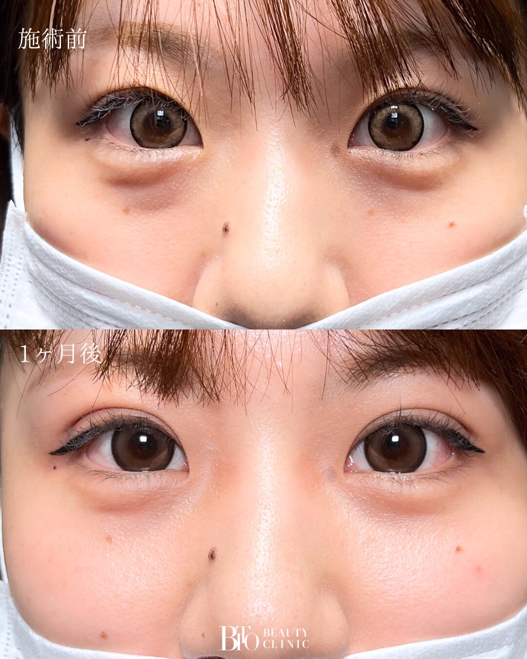 症例写真