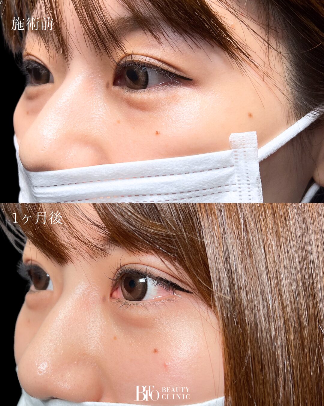 症例写真