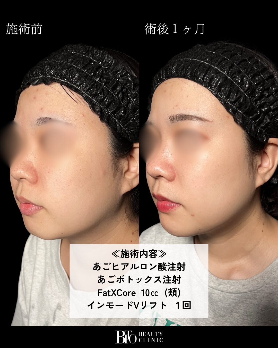 症例写真