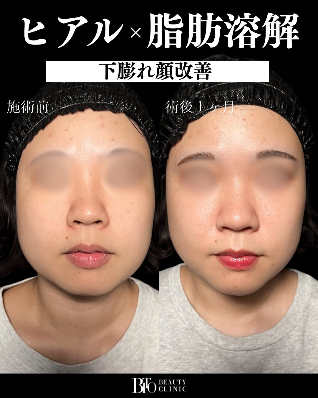 症例写真