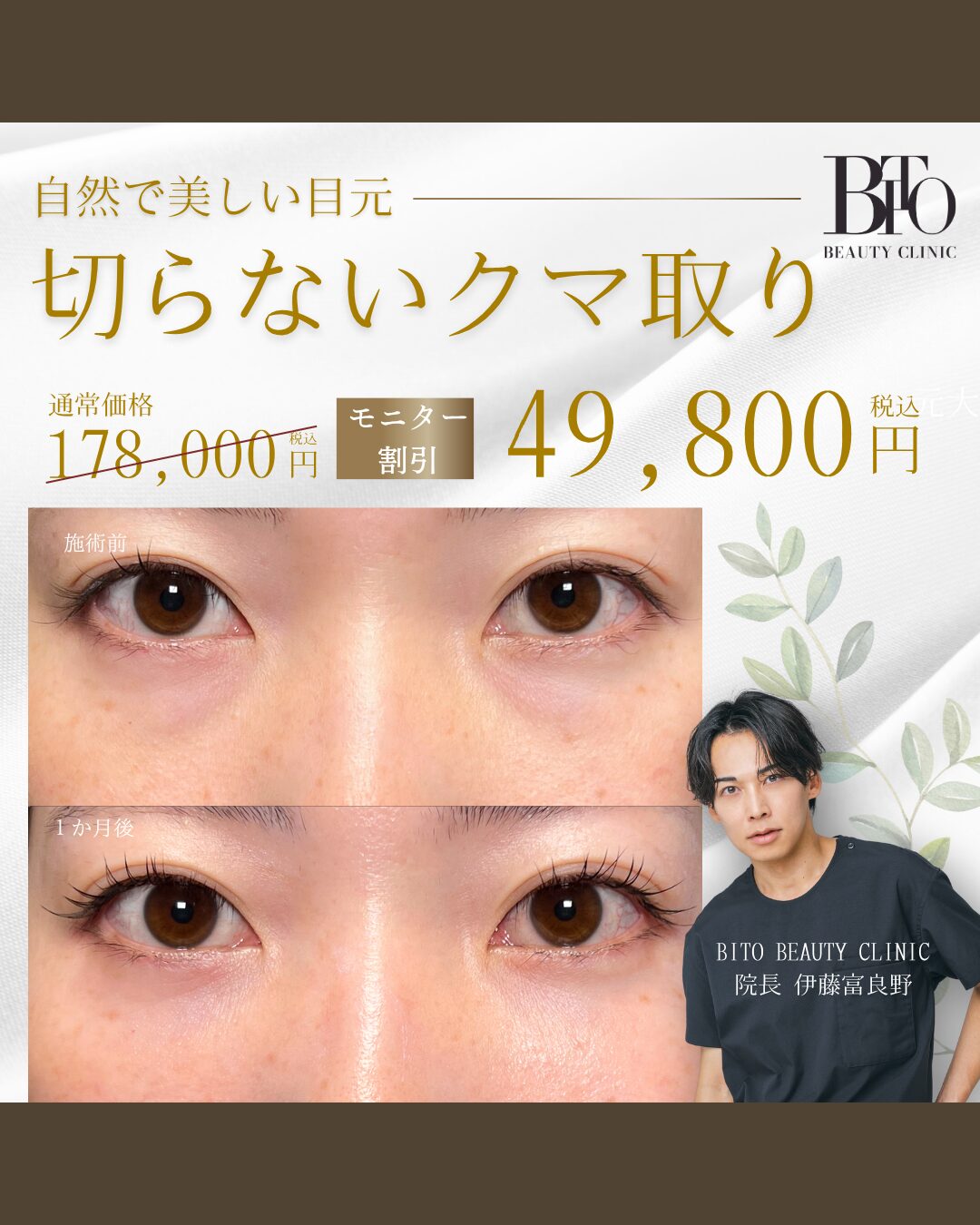 切らないクマ取り ￥49,800