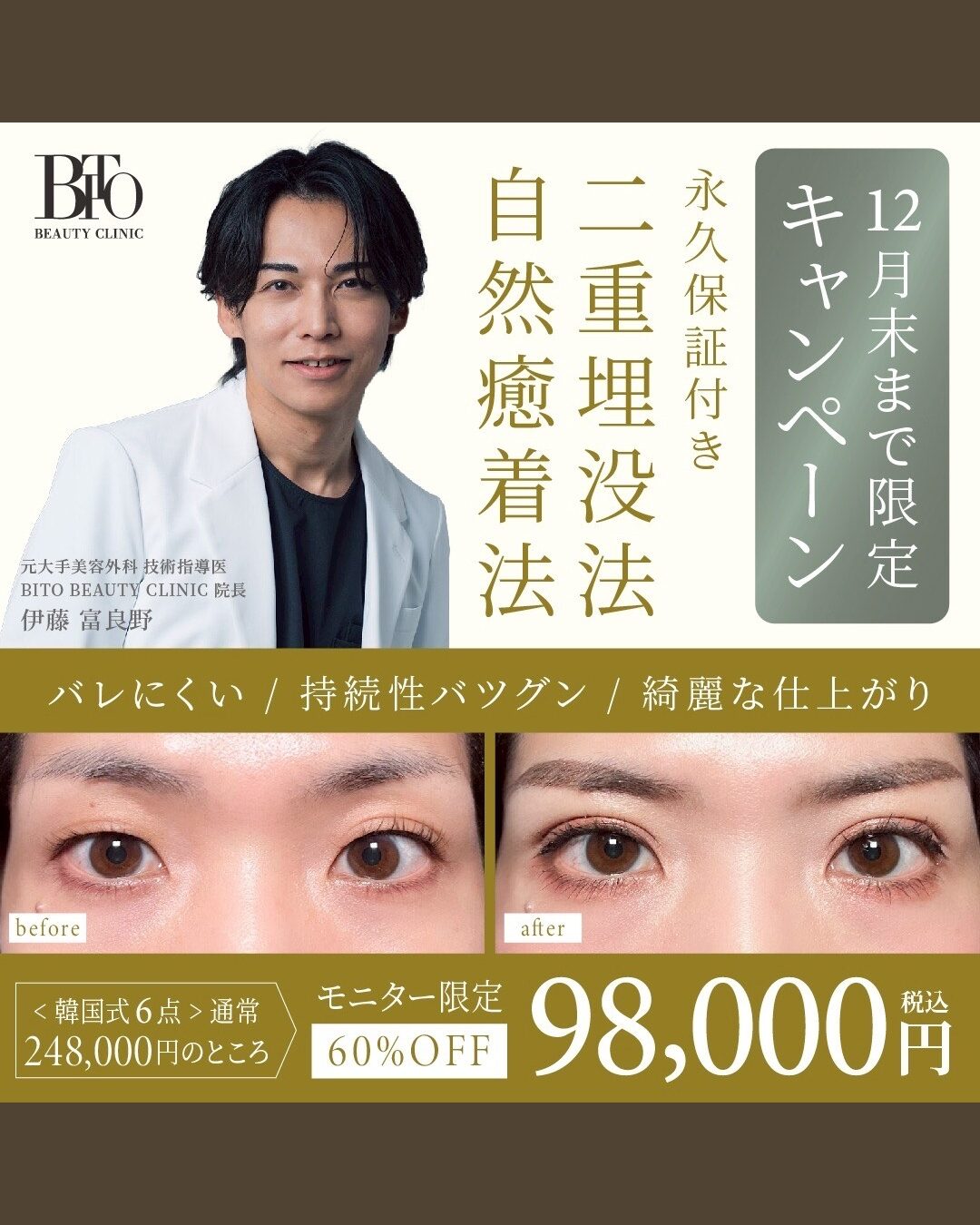 12月キャンペーン:二重埋没 自然癒着法 ￥98,000-